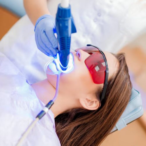 Teeth Whitenin Teeth Whitenin